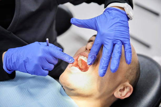 Best Emergency Treatment for Dental Infections or Abscesses in Umatilla, FL